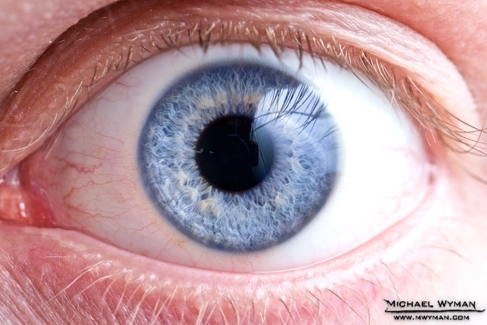 Eye See You